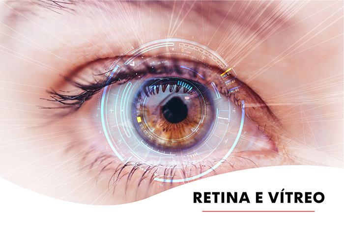 Descolamento de Retina - Instituto de Moléstias Oculares