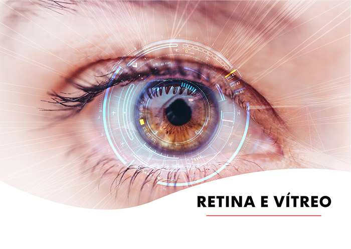 Tratamento da Retina - Instituto de Moléstias Oculares